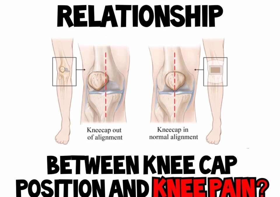Knee cap position and knee pain