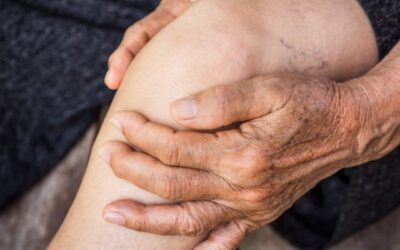 The Best Treatment For Osteoarthritis