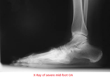 Ankle image