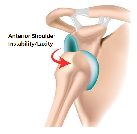 AC joint injury