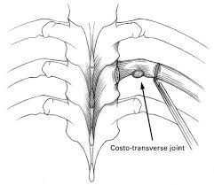 AC joint injury